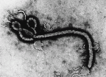 Dez informações que você precisa saber sobre o Ebola