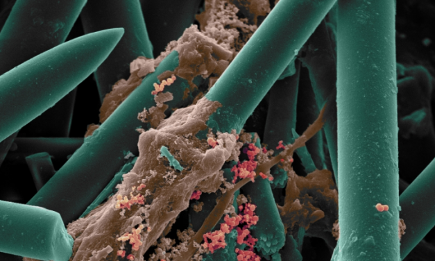 Esponjas marinhas são usadas para enxertos ósseos