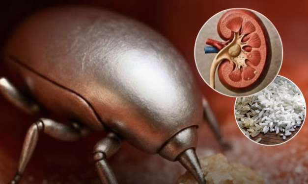Robô microscópico dissolve pedras nos rins